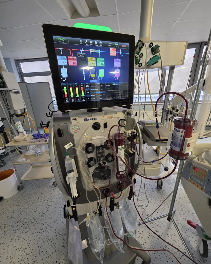 Baxter PrisMax machine running continuous dialysis (CVVHDF)